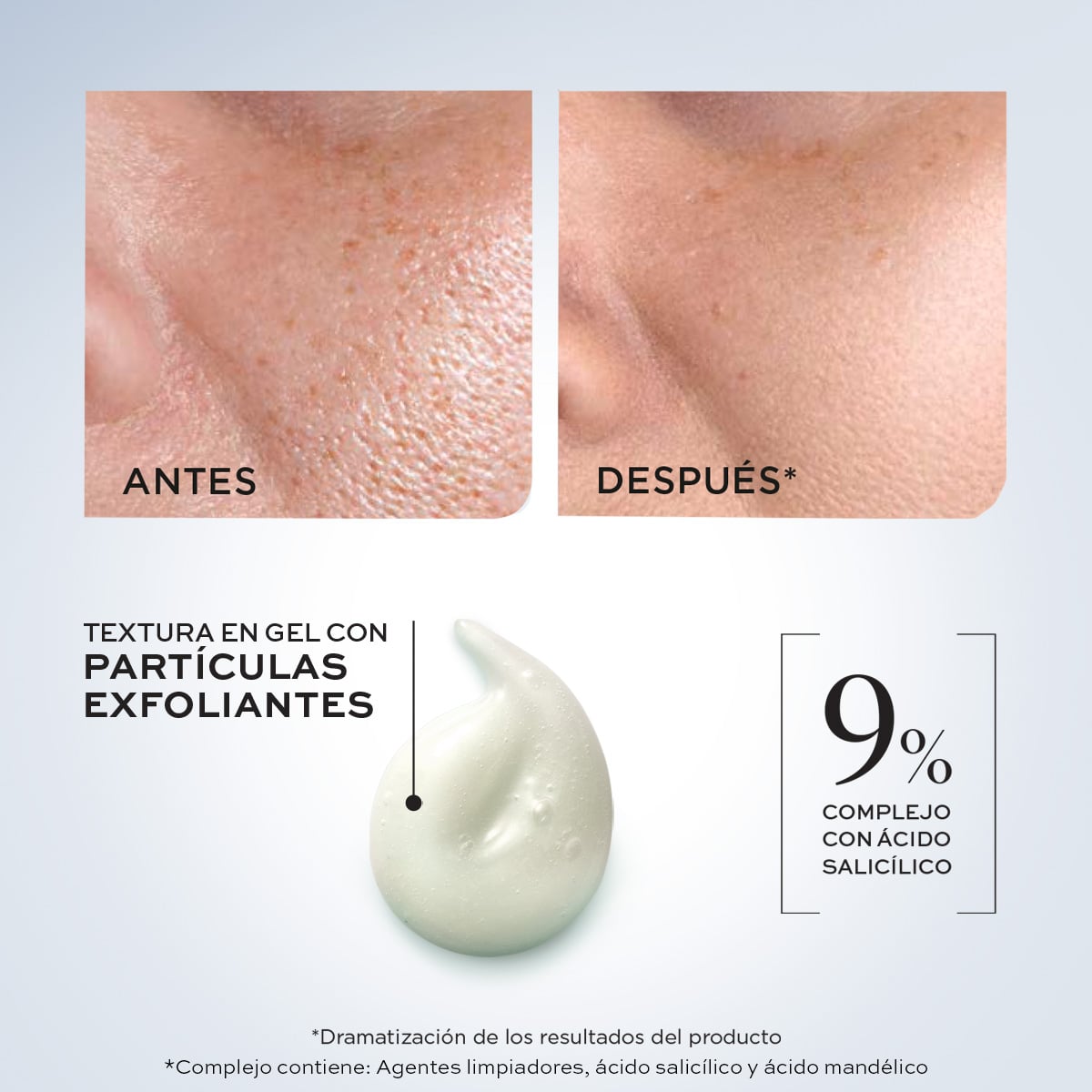 ESSENTIAL de L'BEL – Gel Limpiador con Ácido Salicílico y Exfoliantes para Piel Mixta a Grasa 4.2oz